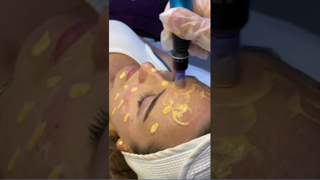 Effective Solutions with Stretch Marks Treatment in Dubai Effective Solutions with Stretch Marks Treatment in Dubai